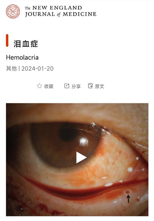 为什么选择 Bitpie 官网下载：真实案例分析_为什么选择 Bitpie 官网下载：真实案例分析_为什么选择 Bitpie 官网下载：真实案例分析